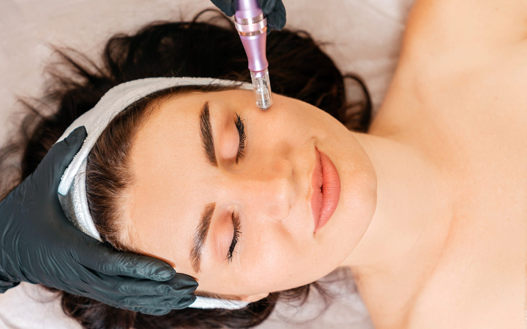 « Le Collagène à la Pointe de l’Aiguille : Les Bienfaits du Microneedling pour une Peau Rajeunie »